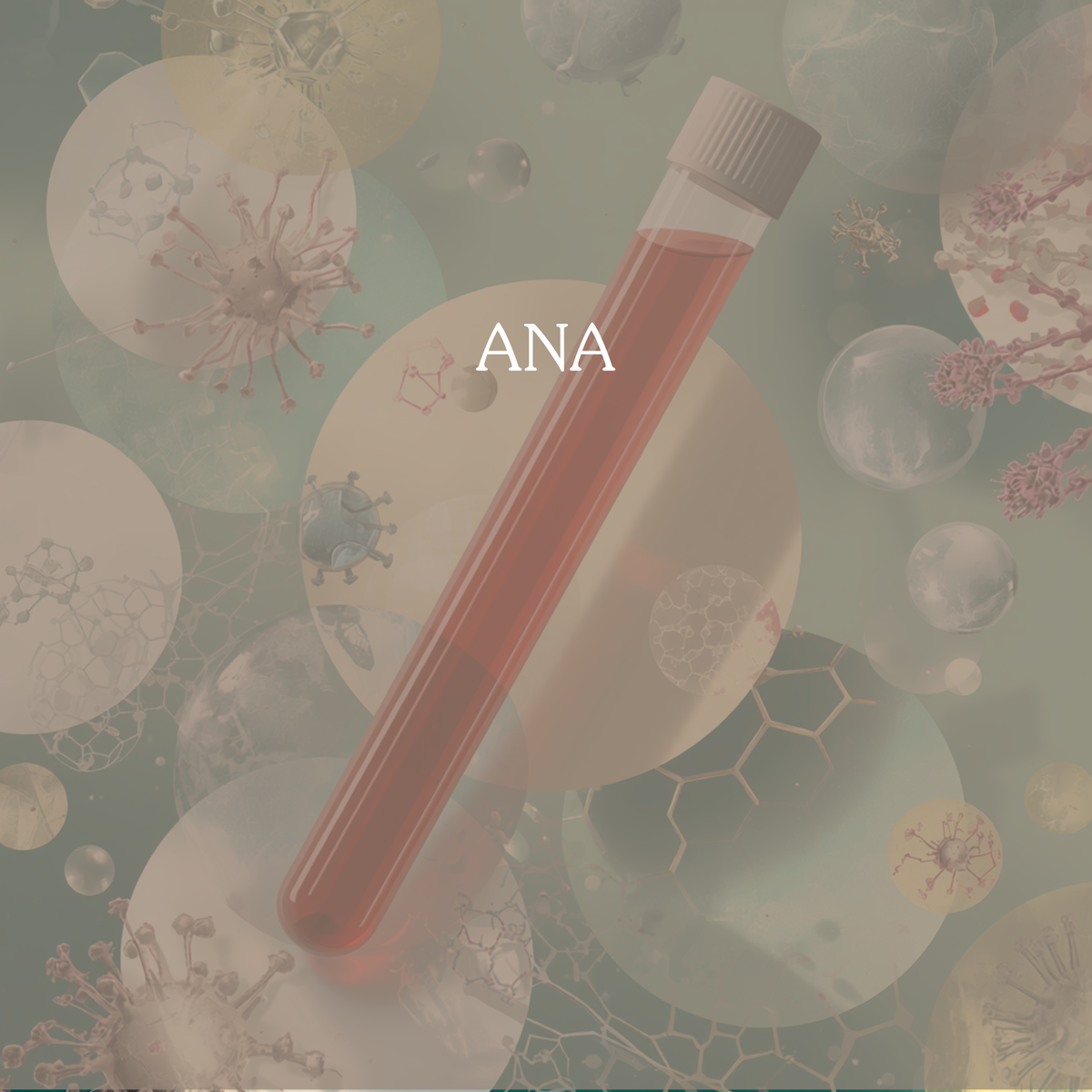 ANA